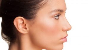 Nâng mũi 100% sụn tự thân sử dụng sụn vành tai để bọc đệm đầu mũi